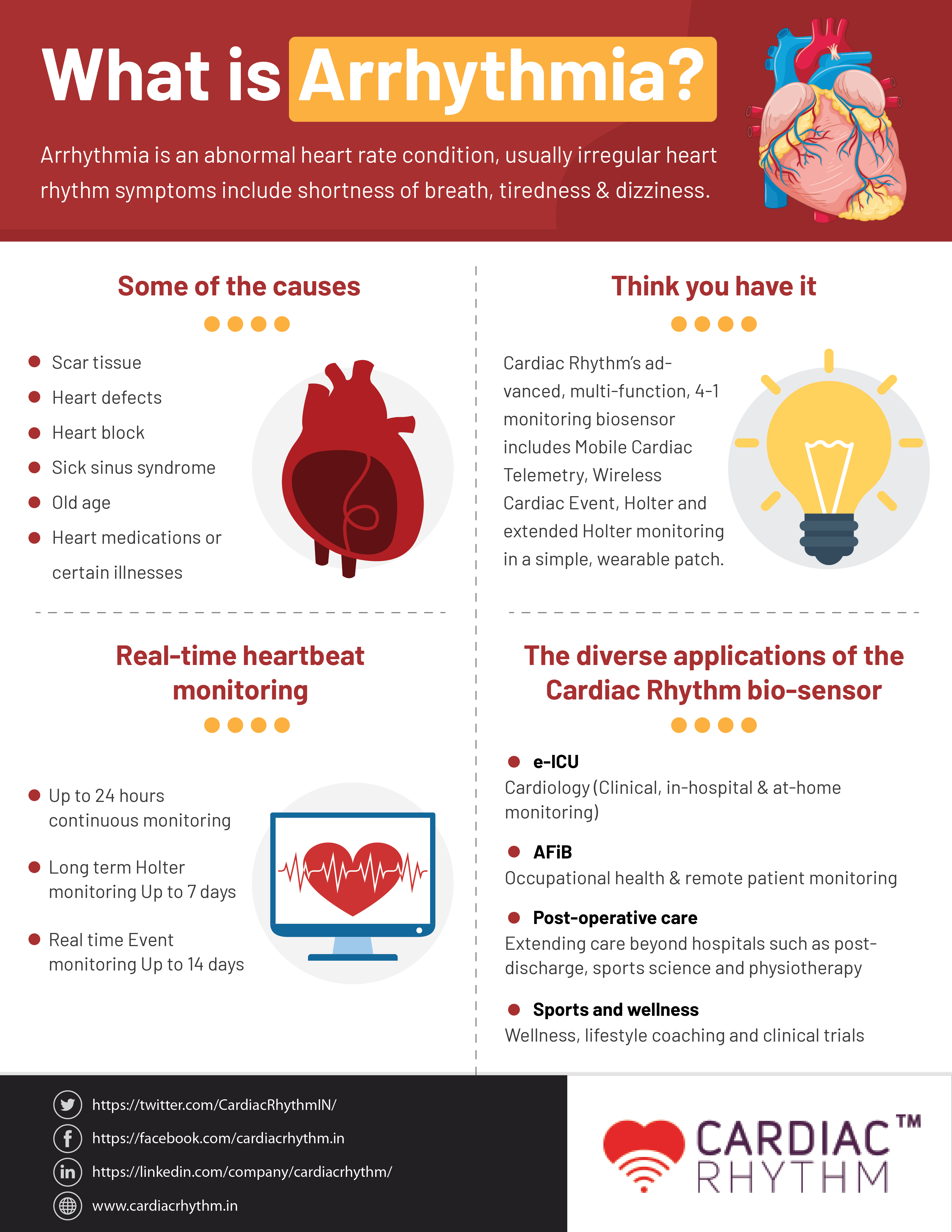 what-is-arrhythmia